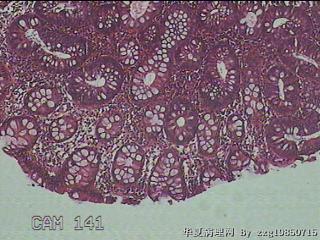 肝曲粘膜图25