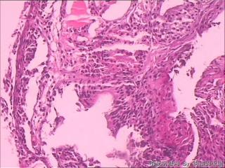 膀胱粘膜图4