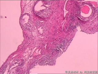 膀胱粘膜图3