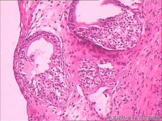 膀胱粘膜图7