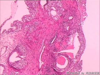 膀胱粘膜图2