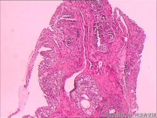 膀胱粘膜图1