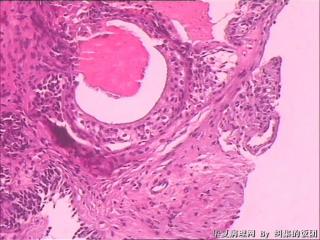 膀胱粘膜图10