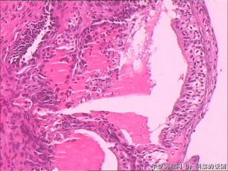 膀胱粘膜图9