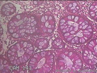 直肠粘膜图13