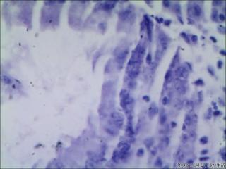 胃角粘膜图16