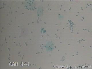 HPV12阳性图28