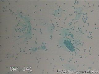 HPV12阳性图25