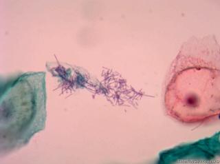 请各位老师看看，这是乳酸杆菌吗？图10