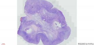 卵巢组织图1