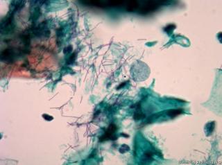 是纤毛菌还是乳酸杆菌？图9