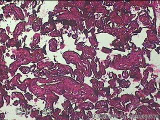 胎盘组织图16
