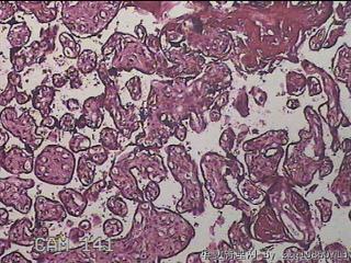 胎盘组织图11