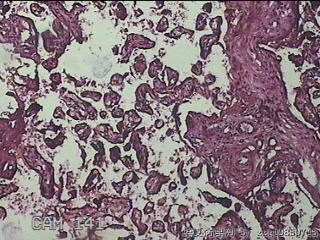 胎盘组织图14