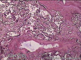 胎盘组织图3