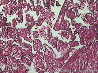 胎盘组织图20