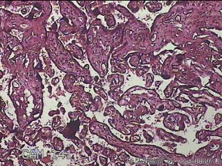 胎盘组织图13