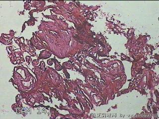 胎盘组织图19