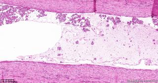 睾丸鞘膜组织，请教一下这些小细胞是什么细胞？图4