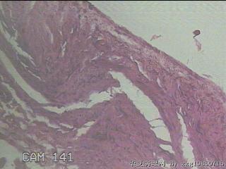 睾丸鞘膜图21
