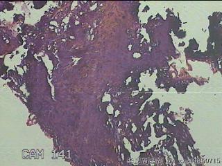 睾丸鞘膜图15