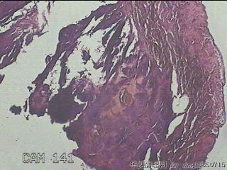 睾丸鞘膜图2