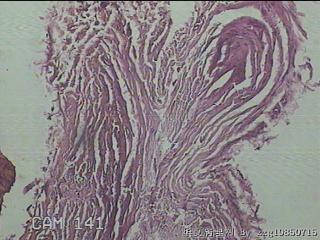 睾丸鞘膜图8