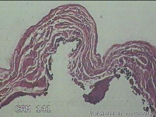 睾丸鞘膜图6