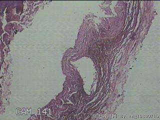 睾丸鞘膜图11