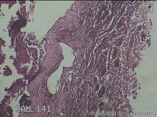 睾丸鞘膜图12