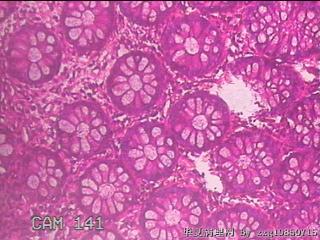直肠粘膜图26
