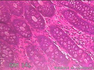 乙状结肠粘膜图15