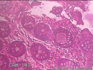 乙状结肠粘膜图1