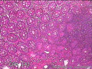 直肠粘膜图3