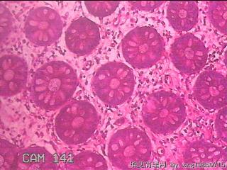 乙状结肠粘膜图3