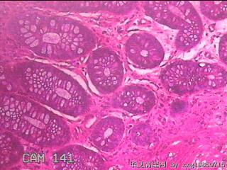 乙状结肠粘膜图22