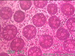乙状结肠粘膜图5