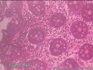 乙状结肠粘膜图7