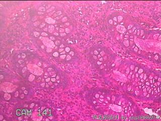 乙状结肠粘膜图8