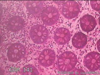 乙状结肠粘膜图6