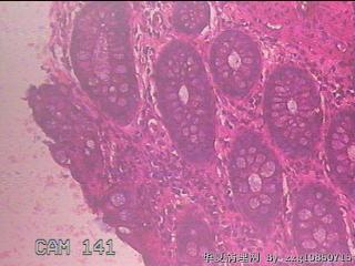 乙状结肠粘膜图18