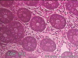 乙状结肠粘膜图2