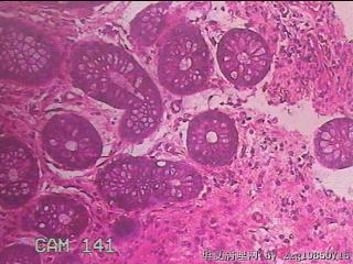 乙状结肠粘膜图24