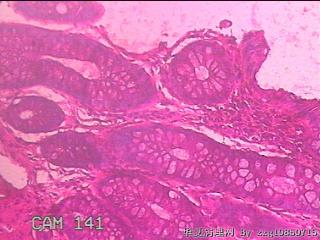 乙状结肠粘膜图16