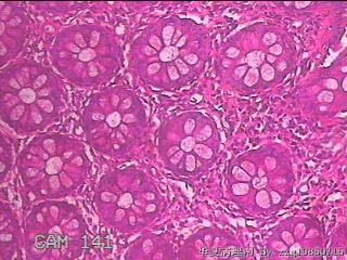 直肠粘膜图23
