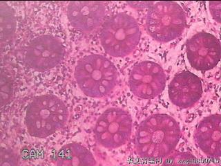 乙状结肠粘膜图4