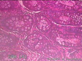 乙状结肠粘膜图10
