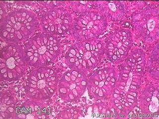 直肠粘膜图17