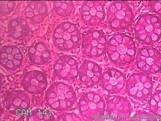 直肠粘膜图14
