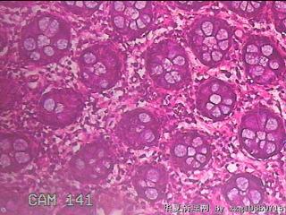 直肠粘膜图16